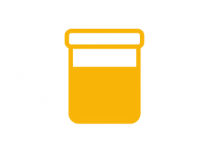 urine sample yellow